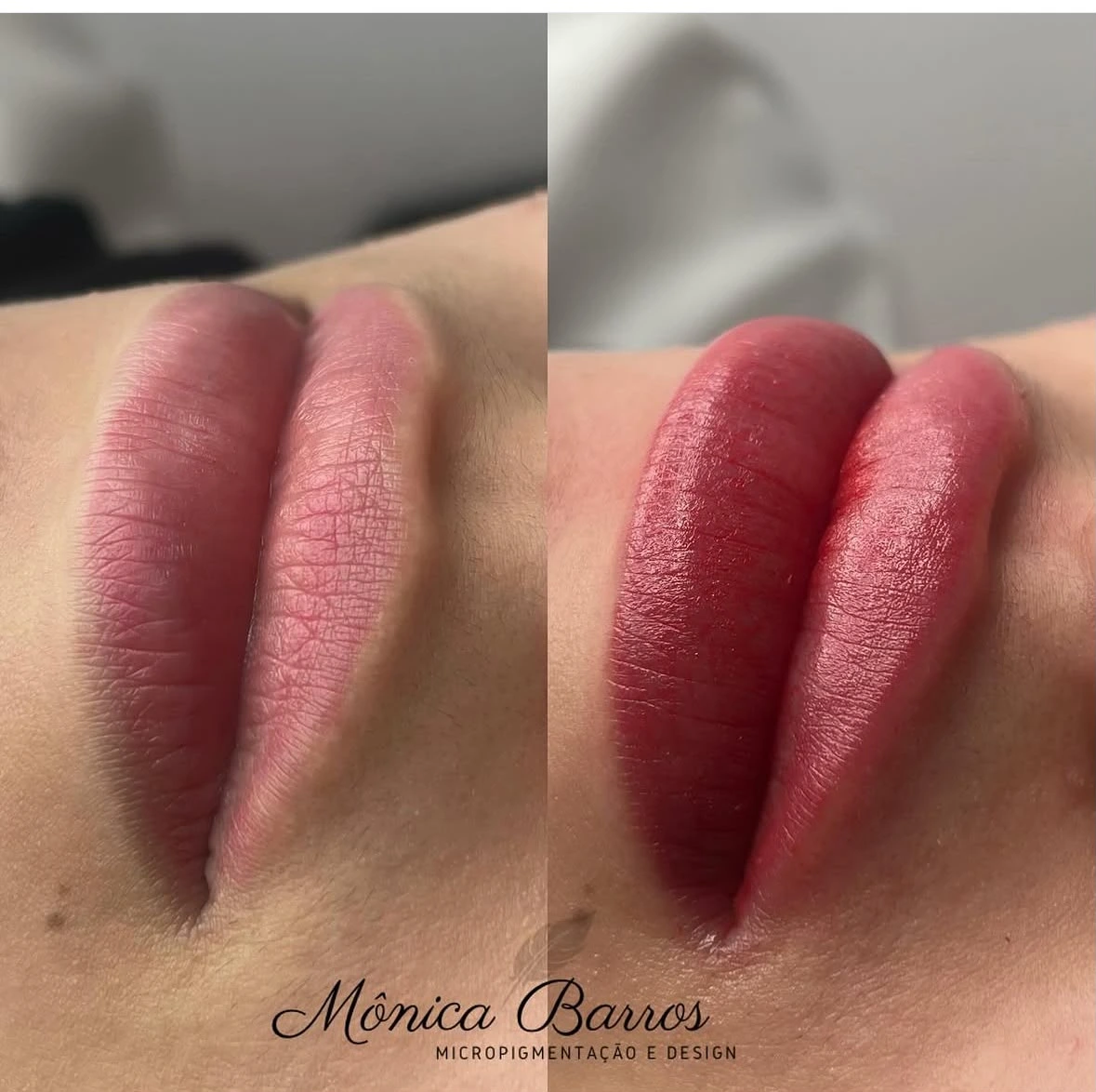 Micropigmentação Labial Antes e Depois 1